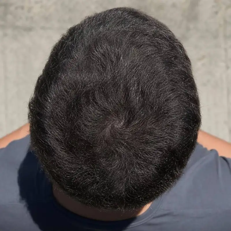 Depois — Juliano, 29