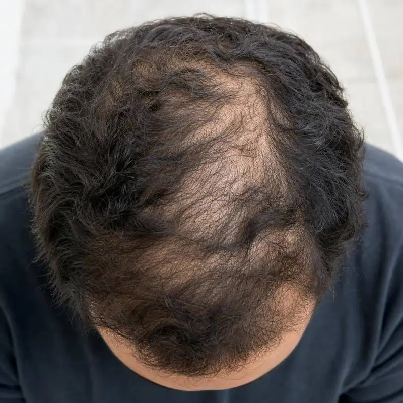 Antes — Juliano, 29